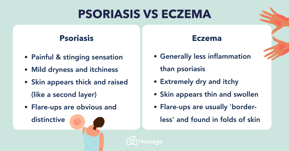 The difference between psoriasis and eczema