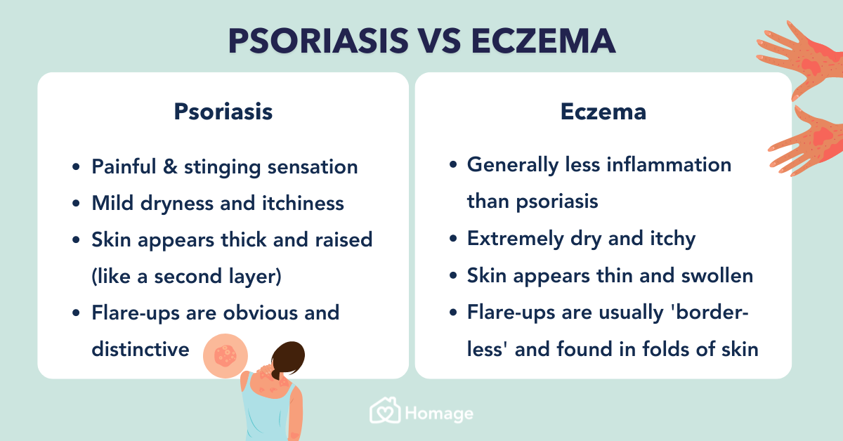 Psoriasis vs Eczema: Symptoms, Triggers & Treatment - Homage Malaysia