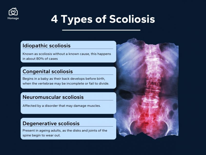 Types of scoliosis